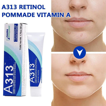 A313 Retinol Cream Face/Body Cream